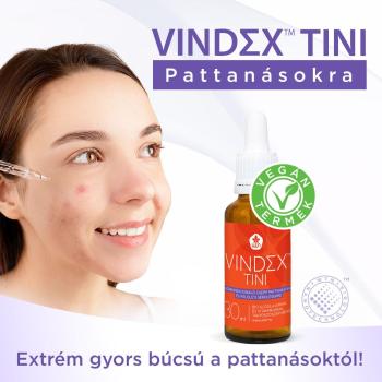 https://nyugalombiobolt.hu/media_ws/10174/2074/idx/wtn-vindex-tini-pattanasra-30ml.jpg
